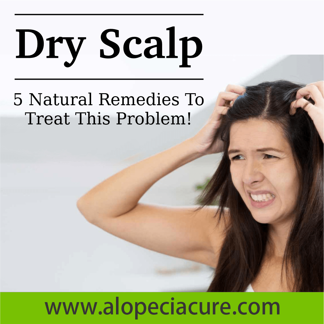 dry scalp solution